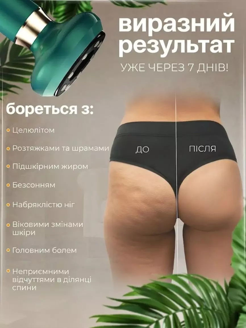 Вакуумний антицелюлітний масажер - Зображення 6