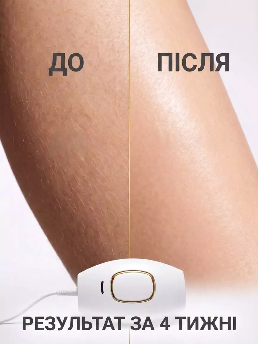 Портативний фотоепілятор - Зображення 4